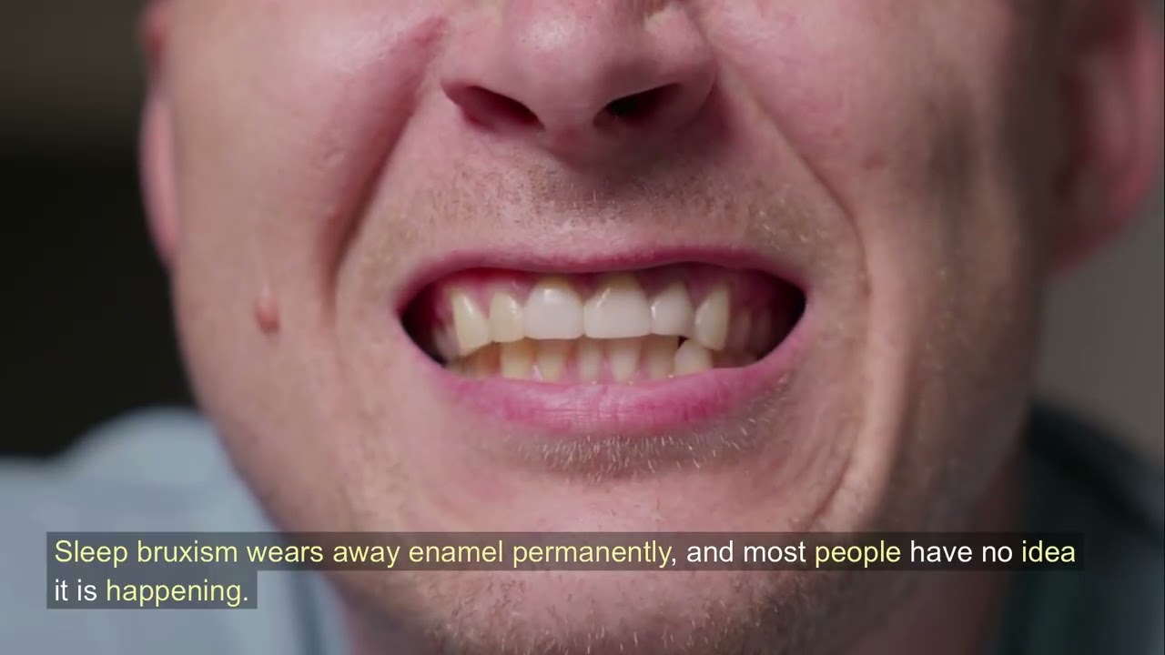 The Real Reason Your Jaw Hurts in the Morning - and Why a Nightguard Might Change Everything
